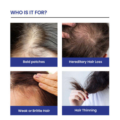 Turbo Hair Growth Serum (Minoxidil 5%)